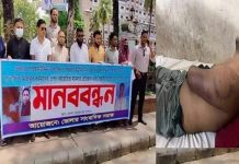 ভোলায় সাংবাদিকের উপর হামলার প্রতিবাদে মানববন্ধন